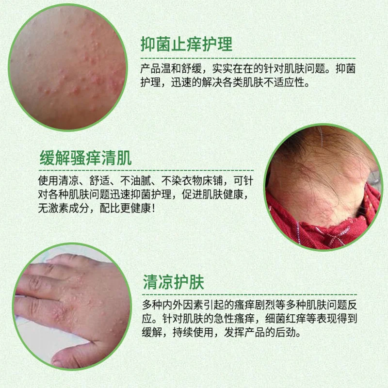Zhengxintang Fuyangling antibakterinis kremas tinka uodų įkandimams, odos anti-itch grietinėlės 20g 4
